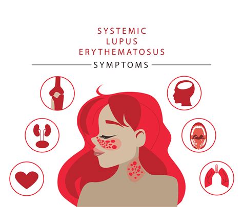 Lupus - Symptoms & causes - Mayo Clinic - muktibox.com