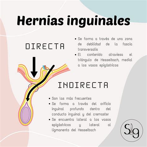 La diferencia entre una hernia directa e indirecta - Estudyando