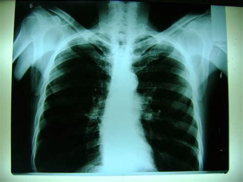 La radiografía de tórax una guía de supervivencia por gerald de lacey. - 2015 bmw g 650 gs manual.