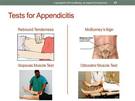 Lab Exams For Appendicitis