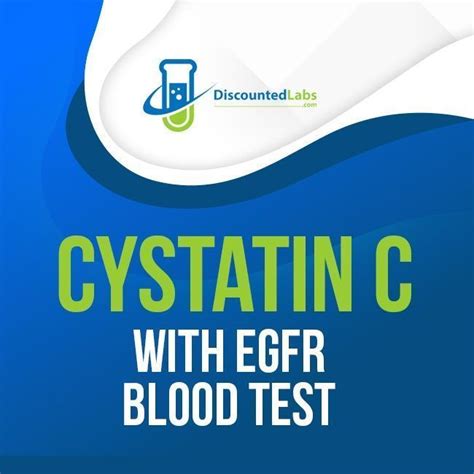 CYSTATIN C. Test ID: Q0283. CPT code: 82610. LOINC: 33863-2. Specimen Type: red gel. Frequency: Mon – Fri; analytic time 2 days. Instructions: Overnight fasting preferred. Refrigerated serum from SST 1.0mL (0.5 mL min) Separate serum or plasma from cells ASAP or w/in 2 hours of collection. Text: Cystatin C is a highly sensitive and specific .... 