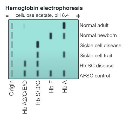 5.1: Hemoglobin Electrophoresis, G-6-PD, Betke-Kleihauer Stains, 