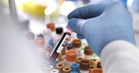 Labcorp lab tests. Things To Know About Labcorp lab tests. 