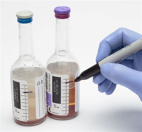 Labcorp sputum culture. a. Sputum, urine, stool, etc. are best collected in early morning and sent to the laboratory the same day. b. Blood. A blood culture requires two bottles of blood—one for aerobic and one for anaerobic culture. Each blood culture should be collected from a separate venipuncture. 