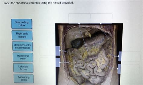 This problem has been solved! You'll get a detailed solution from a subject matter expert that helps you learn core concepts. Question: https Connect-B.. A&PRevealed Urinaryx Saved d Urinary Label the non-urinary posterior abdominal structures using the hints provided artery It renal arten Superior artery Right renal Ceiac artery Ab Reset Zoom .... 