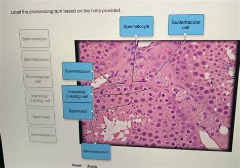 Label the photomicrograph based on the hints provided Zona fasciculata Medulla Suprarenal gland Capillary Zona reticularis Your solution’s ready to go! Our expert help has broken down your problem into an easy-to-learn solution you can count on..