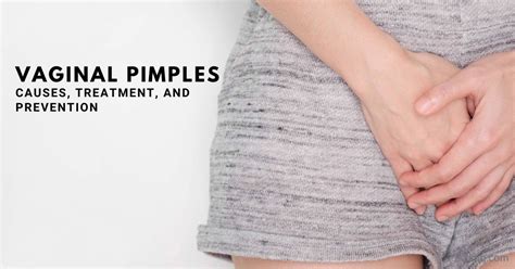 Pimple on Labia is often not an indication of anything severe, but they can be bothersome in everyday life. It’s better to avoid attempting to pop the pimple on Labia. For one reason, it has the potential to transmit germs and cause infection. Similarly, you might confuse it with the vaginal cyst. Furthermore, this delicate area is easily .... 