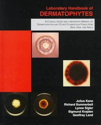 Laboratory handbook of dermatophytes a clinical guide and laboratory handbook of dermatophytes and other filamentous. - Fahrenheit 451 de ray bradbury questionnaire de lecture.