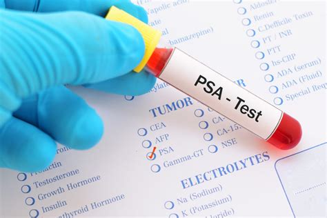 Labtestsonline - PSA