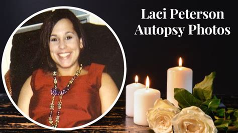 Dr. Peterson's testimony provided support to the bizarre theory – but others reviewed the autopsies on mother and child to find evidence that the infant died in his mother's womb, and floated free as Laci's corpse decomposed. The autopsy report reveals that Laci's cervix was intact and closed," said forensic pathologist Dr. Robert H. Goldberg.. 