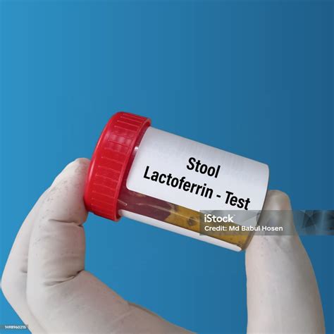 Lactoferrin in stool Testing what it means and more