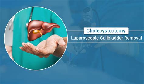 Laparoscopic Gallbladder Removal near Gastonia, NC WebMD