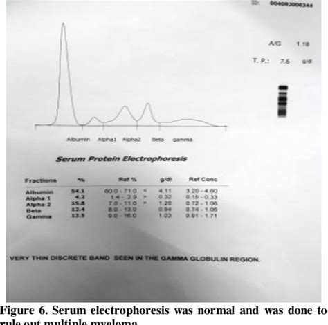 Laryngeal amyloidosis: A rare aetiology of hoarseness