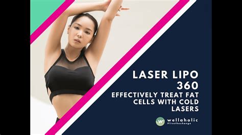 Laser Lipo 360 - Wellaholic