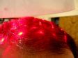 Laser RayMax Therapy By - HairSpec