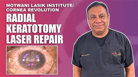 Laser radial. .  <a href=https://mirekip.ru/oyry9/help-bbw-getting-fatter-and-fatter-like-hip...