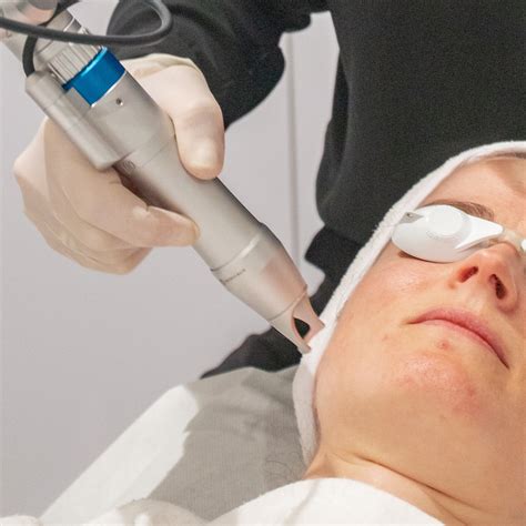 Laser treatments Skin clinic, Australia