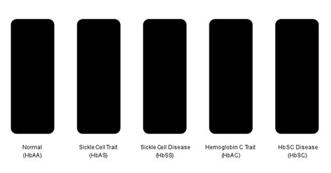 Lateral Flow Assays for Sickle Cell Disease Rockland