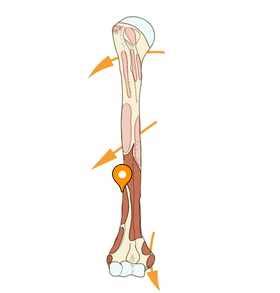 Lateral border of humerus - e-Anatomy - IMAIOS