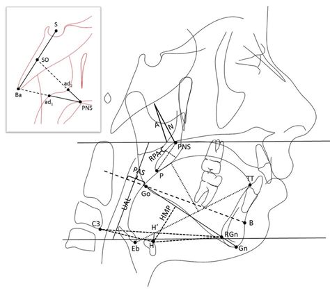 Lateral cephalometric analysis. Download Scientific Diagram