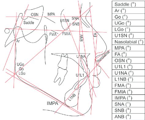 Lateral cephalometric tracing with angular measurements Download