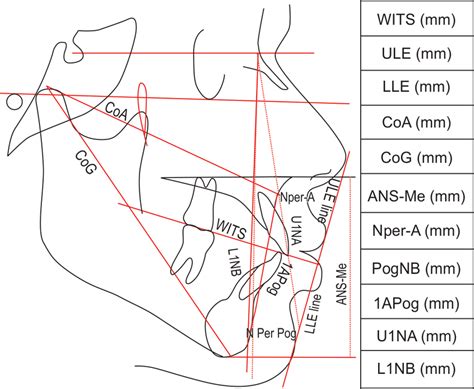 Lateral cephalometric tracing with linear measurements Download