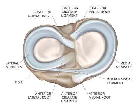 Lateral menisküs anterior ve posterior boynuzda grade I dejenerasyon izlendi.