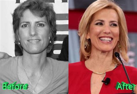 By Oli and Alex. March 11, 2024. 0. 62. In ‍recent years, rumors ‍and speculation ⁣about Laura Ingraham’s possible plastic ⁤surgery‌ have circulated in the media. This controversial ⁤topic has sparked debate and ‍curiosity among ⁣her fans and critics alike. ‌Let’s ⁢delve into the details and find out the truth behind the .... 