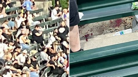 Lawyer for woman injured in White Sox shooting denies she brought firearm into the ballpark as police continue their investigation