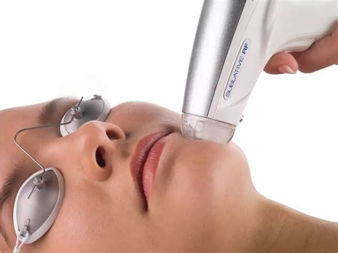 Lazerle Yüz Gerdirme. 