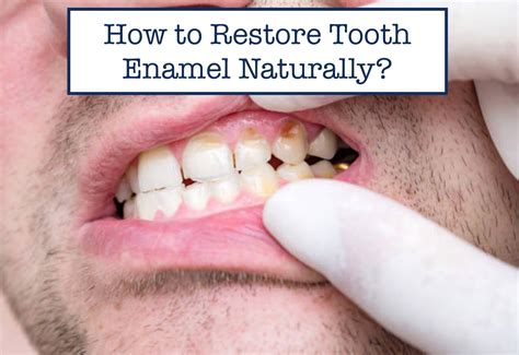 Learn How to Rebuild Tooth Enamel Naturally Expert Advice