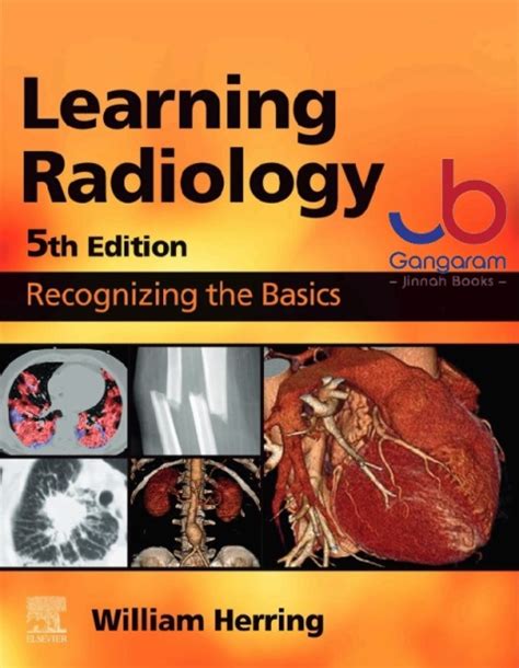 Learning Radiology Recognizing The Basics