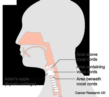 Learning to speak again Laryngeal cancer Cancer Research UK