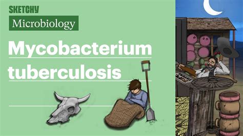 Lec 27 - Myco. Tuberculosis Sketchy/notes Flashcards