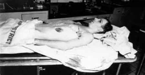 Lee harvey oswald autopsy pictures. Things To Know About Lee harvey oswald autopsy pictures. 