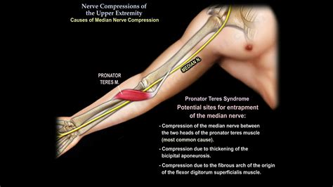 Left arm nerve pain reddit.  My nerve was compressed for over a year due...