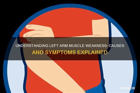 Left arm weakness anxiety.  Nov 27, 2025 · Muscle weakness refers to ...