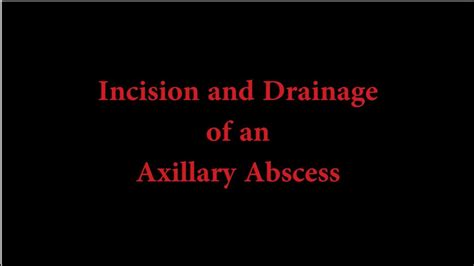 Left axilla abscess icd 10. Things To Know About Left axilla abscess icd 10. 