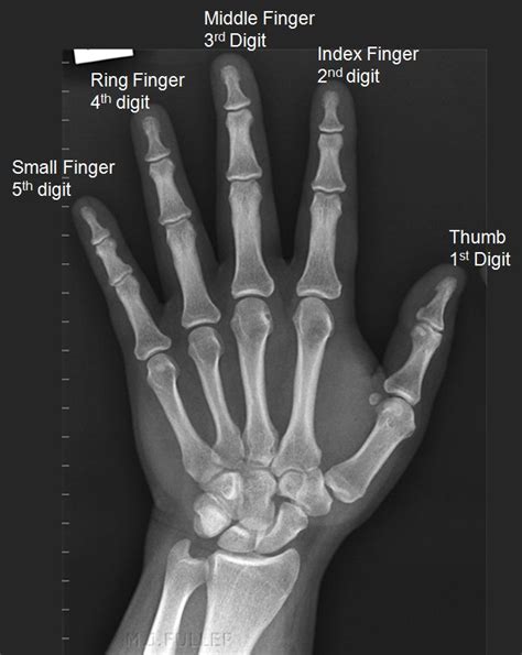 Left middle finger trigger finger icd 10. Things To Know About Left middle finger trigger finger icd 10. 