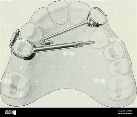 Lehrbuch der orthodontie fur studierende und zahnartze mit enschluss der geschichte der orthodontie. - Yamaha xv 1600 road star 1999 2006 service manual download.