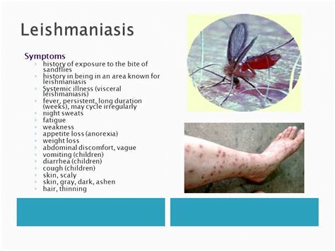 Leishmaniasis: Causes, Diagnosis, & Treatment - Healthline