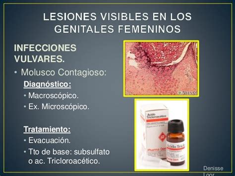 Lesiones genitales femeninos externos. .  <a href=https://stpoint.ru:443/a9ncrb/battlefie...
