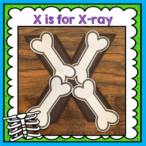 Letter X Craft - X is for X-Ray (teacher made) - Twinkl