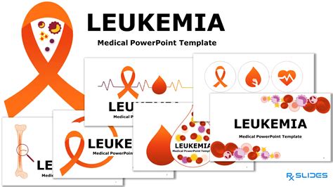 Leukemia ppt template.  Ricardo A.  But while acute lymphocytic leukemia most commo...