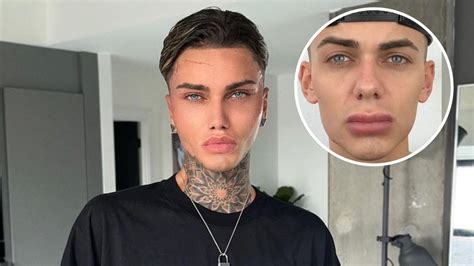 Aug 31, 2023 · TikTok star Levi Jed Murphy has spoken out about his candid reactions to his “dramatic” plastic surgeries.. Murphy reflected on his experiences with plastic surgery – weeks after sharing ... . 