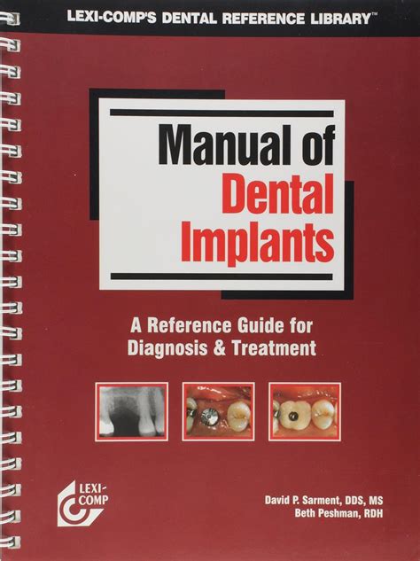 Lexi comps manual of dental implants. - Major appliance service national price guide.