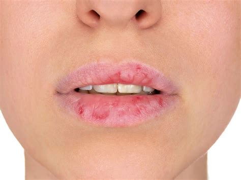 Like a chapped lip crossword. Things To Know About Like a chapped lip crossword. 