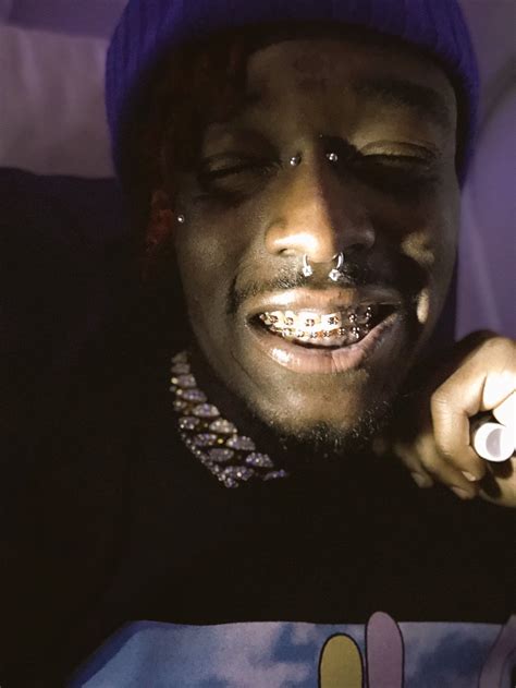 Lil uzi braces. Uzi also pointed out that the incident happened a long time ago since he was seen sporting braces in the photos. "S**t old I don't even got braces," the hip-hop star wrote in a separate tweet. 