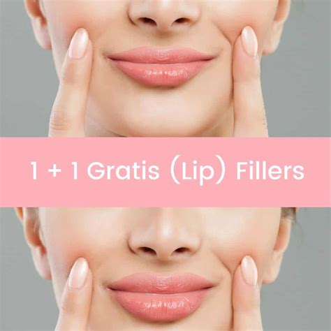 Lip fillers 2ml - Lippen opvullen - koop online