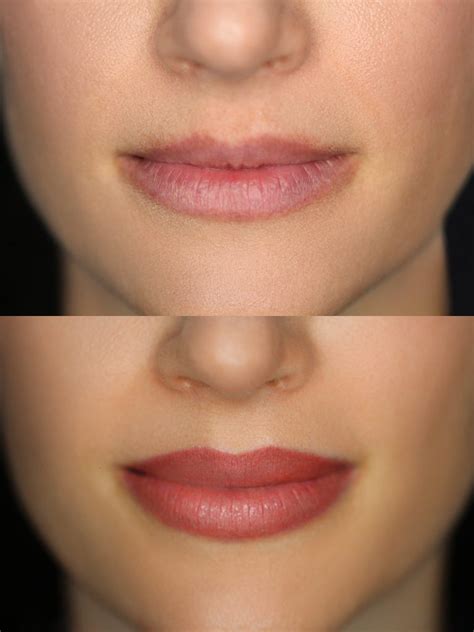 Lip tattoo near me. Laser lip tattoo removal works on the principle of breaking down the unwanted pigments, and enabling the body to extract them. The pigment is targeted by a laser beam which penetrates the skin, and its energy breaks down the molecules into smaller particles. The so-called “scavenger cells” in the blood trap … 